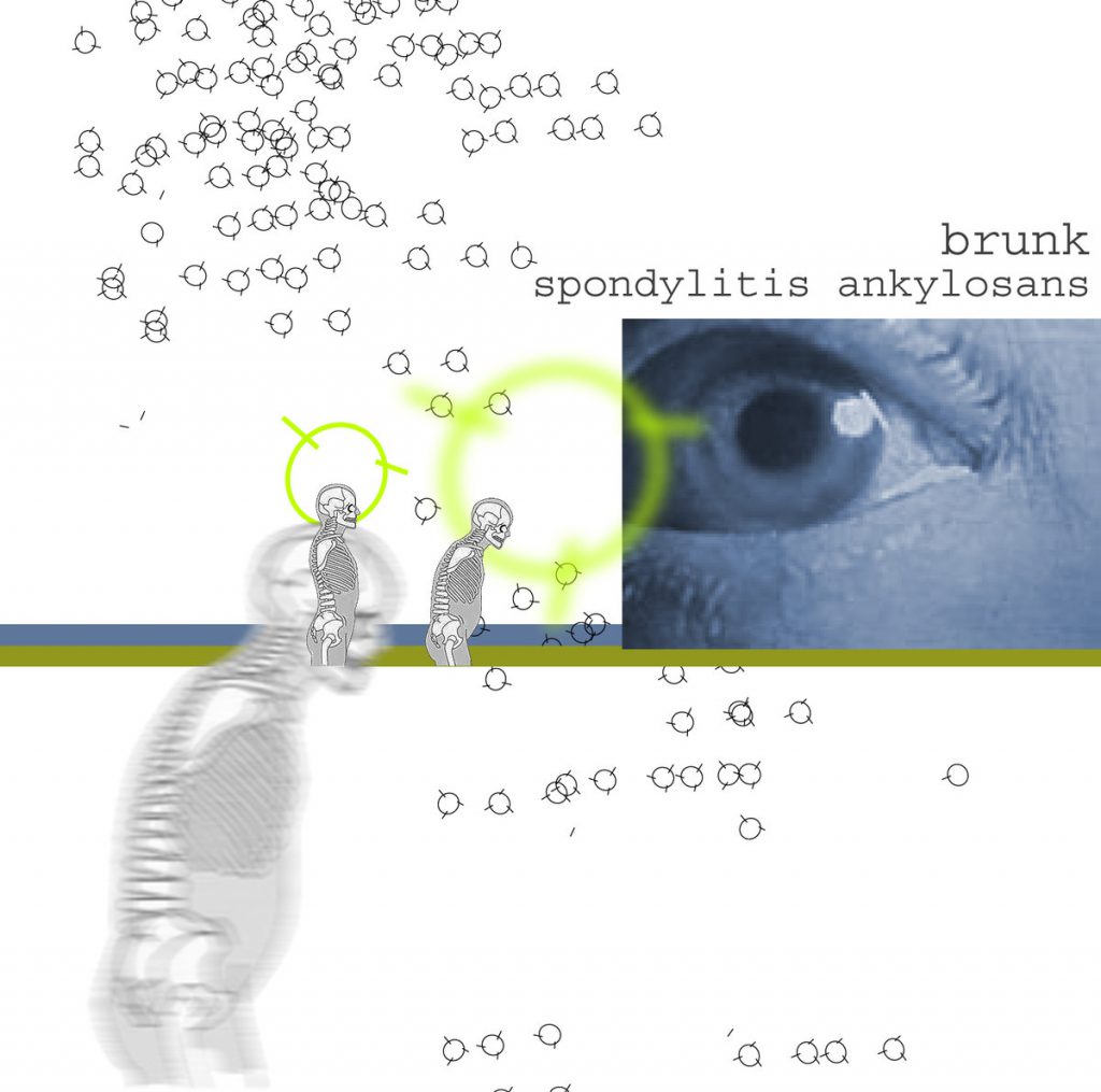 brunk – spondylitis ankylosans - album artwork
